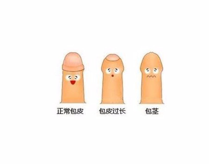 男科检查是否需要脱裤子？这个问题的答案其实没有那么绝对。